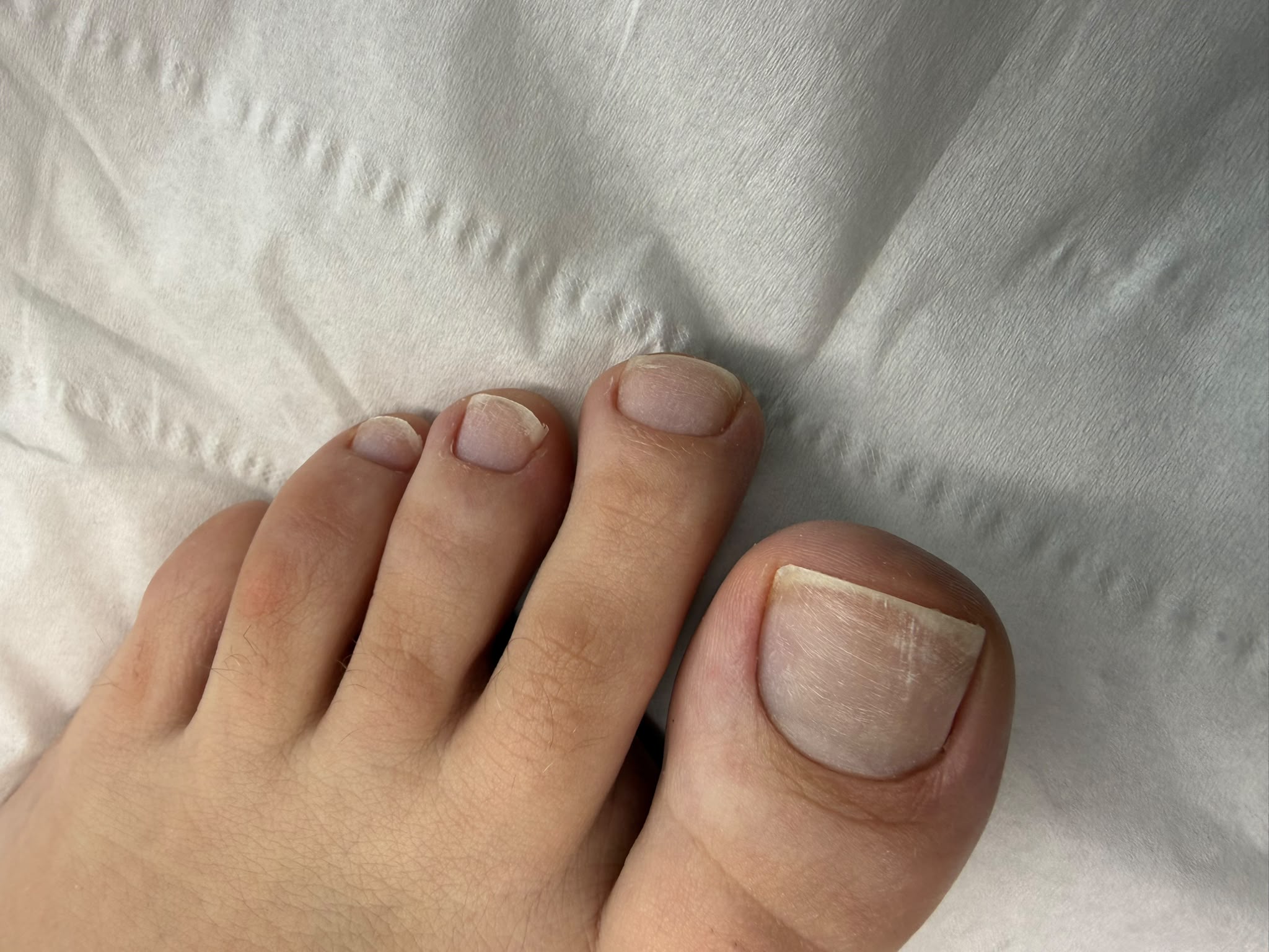 Pédicure et soins