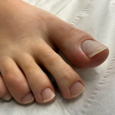 Pédicure et soins